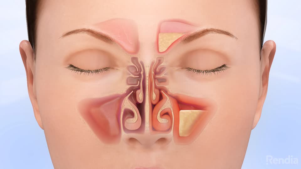 nose and sinuses