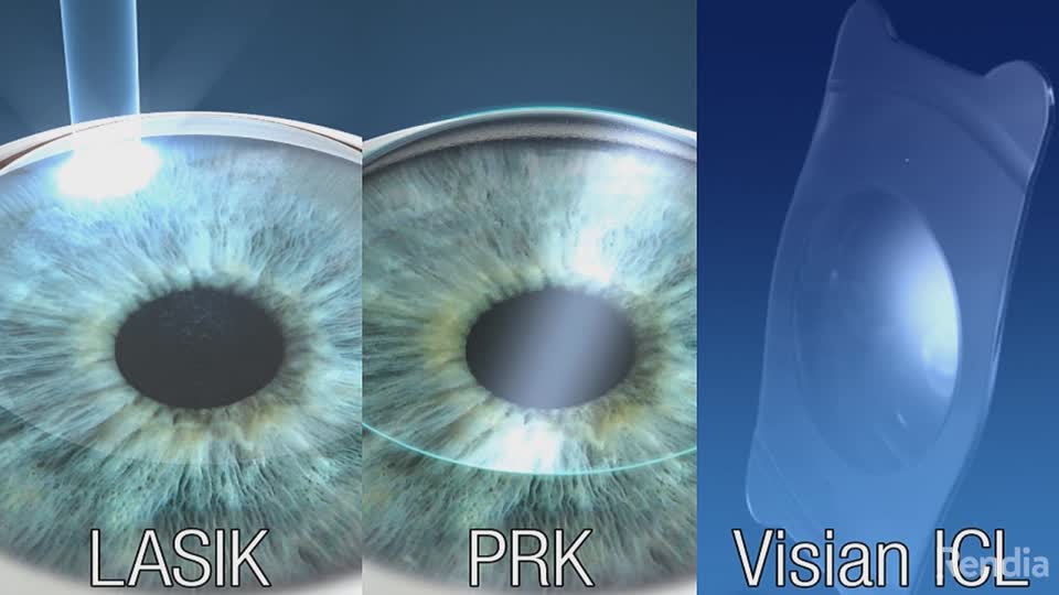 Guide To Lasik Eye And Vision Surgery All About Vision