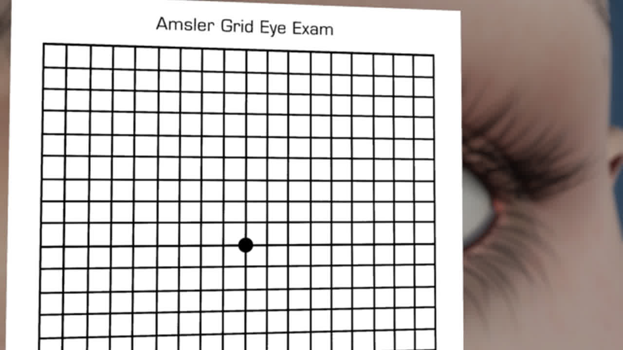 How To Use The Amsler Grid To Detect Age Related Macular